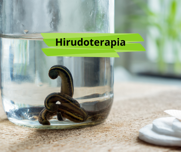 Hirudoterapia - jak można wykorzystać w fizjoterapii? - Fizjo Gabinet